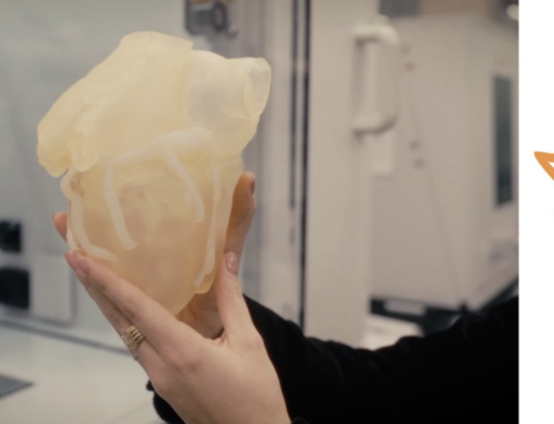3D HEART SAVES LIFE OF YOUNG ACTRESS WITH RARE TUMOR